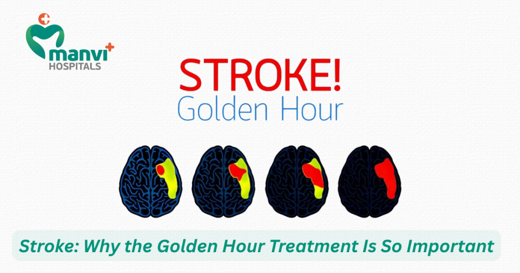 Stroke: Why the Golden Hour Treatment Is So Important